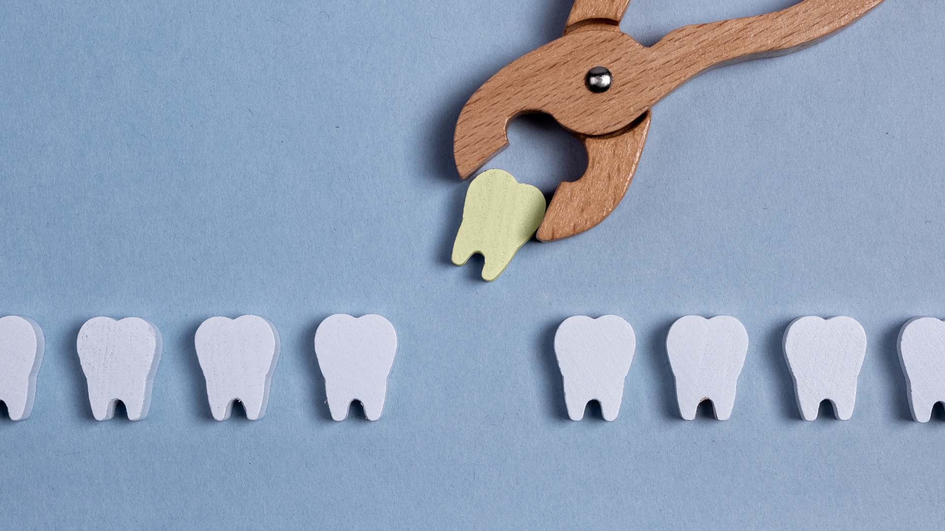 Последствия при загуба на зъб
